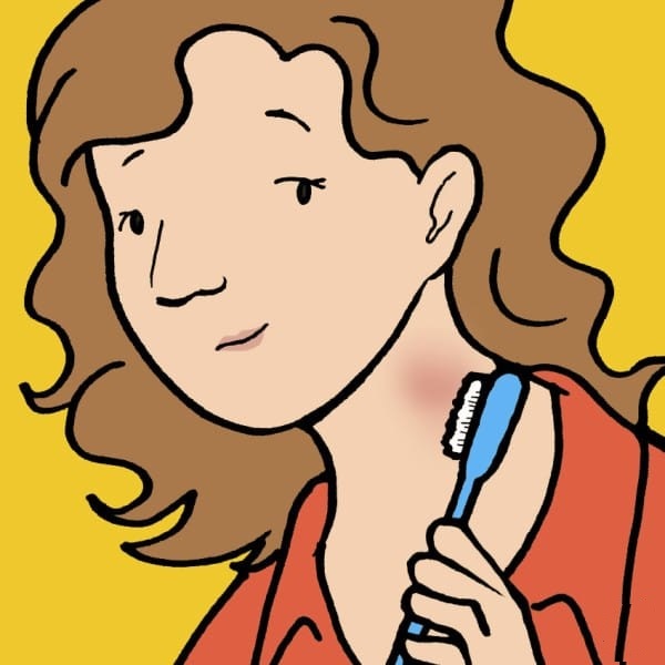 how to get rid of a hickey